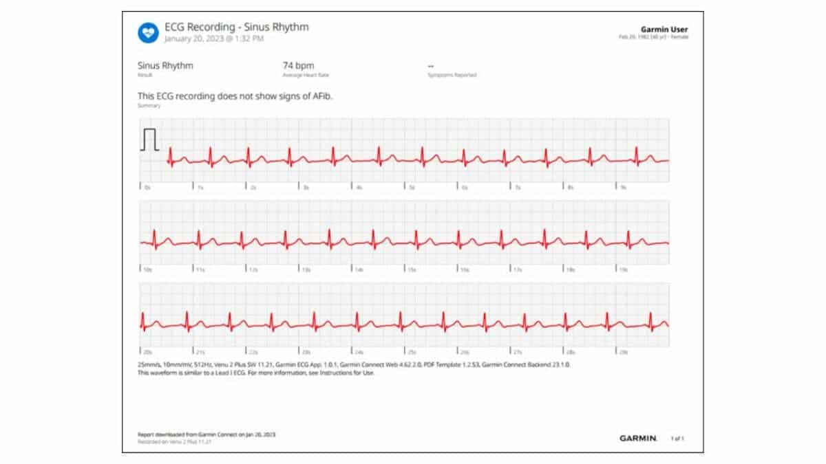 Garmin ECG App Launched Here's How it Works!